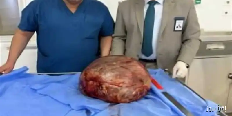 استئصال ورم ضخم يزن 40 كيلو جرامًا: تفاصيل عملية جراحية معقدة استمرت 6 ساعات في معهد ناصر